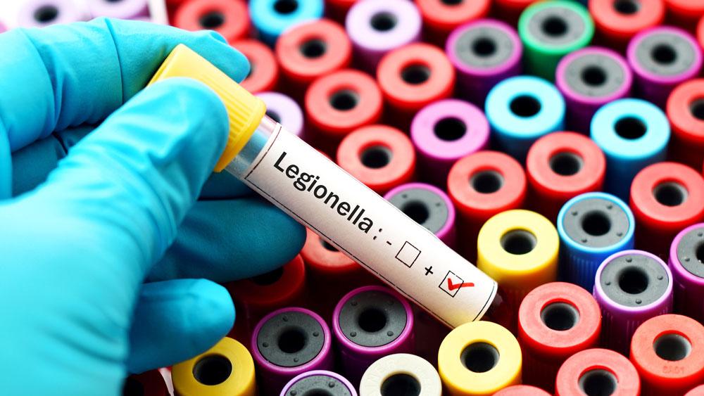 Legionelle echantillon